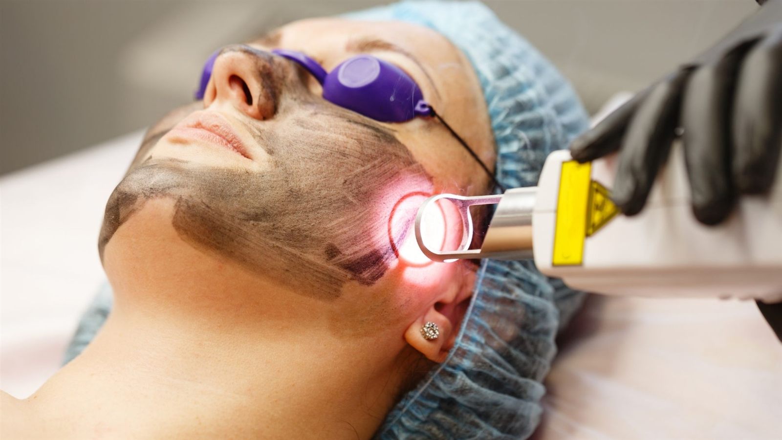 Anti-Aging Facials in Boston, MA